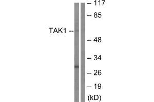 Image no. 2 for anti-Nuclear Receptor Subfamily 2, Group C, Member 2 (NR2C2) (Thr184) antibody (ABIN1848062)