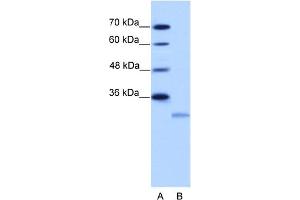 Image no. 1 for anti-Eukaryotic Translation Initiation Factor 4E Family Member 2 (EIF4E2) (N-Term) antibody (ABIN2778915)