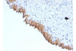 Image no. 1 for anti-Mastermind-Like 2 (MAML2) antibody (ABIN5707979)