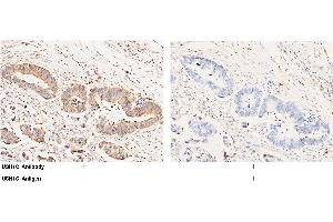 anti-Usher Syndrome 1C (Autosomal Recessive, Severe) (USH1C) (AA 1-552) antibody