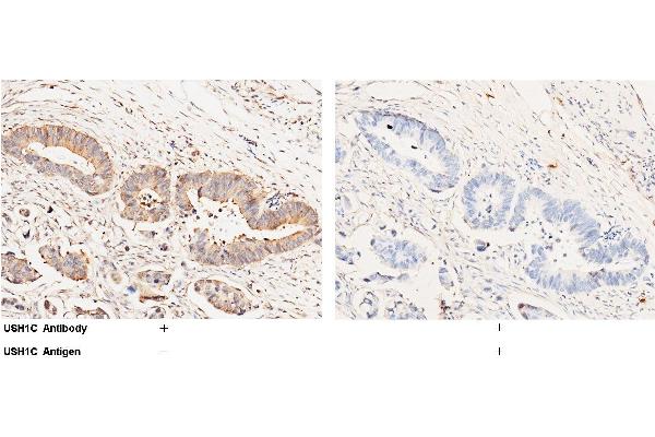 anti-Usher Syndrome 1C (Autosomal Recessive, Severe) (USH1C) (AA 1-552) antibody