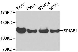 Image no. 3 for anti-Spindle and Centriole Associated Protein 1 (SPICE1) antibody (ABIN6148351)