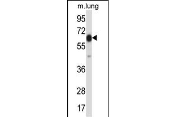 POF1B antibody  (AA 337-366)