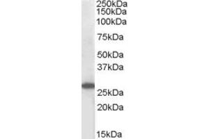 Image no. 2 for anti-Suppressor of Cytokine Signaling 3 (SOCS3) (C-Term) antibody (ABIN184566)