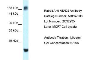 Image no. 1 for anti-ATPase Family, AAA Domain Containing 2 (ATAD2) (C-Term) antibody (ABIN2789063)