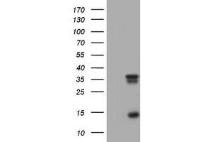 Image no. 6 for anti-Thymidylate Synthetase (TYMS) antibody (ABIN1501595)