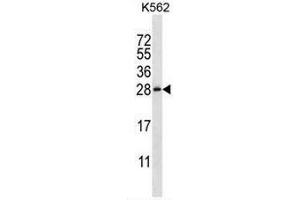 Image no. 2 for anti-Chorionic Somatomammotropin Hormone-Like 1 (CSHL1) (AA 132-152), (C-Term) antibody (ABIN951712)