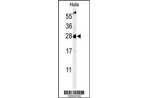 Image no. 1 for anti-RAB8A, Member RAS Oncogene Family (RAB8A) antibody (ABIN1881723)