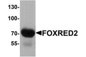 Western blot analysis of FOXRED2 in human lung tissue lysate with FOXRED2 antibody at 1 μg/mL.