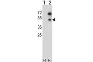 Image no. 4 for anti-GNAS Complex Locus (GNAS) (AA 286-315), (C-Term) antibody (ABIN952563)