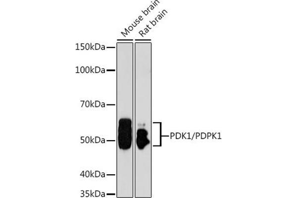 PDPK1 antibody  (AA 150-429)