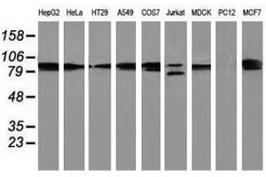 Image no. 2 for anti-Protein Kinase C, epsilon (PRKCE) antibody (ABIN1500232)