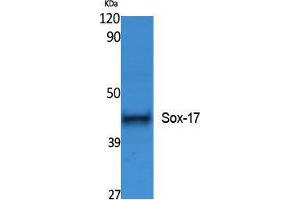 Image no. 1 for anti-SRY (Sex Determining Region Y)-Box 17 (SOX17) (Internal Region) antibody (ABIN3187621)