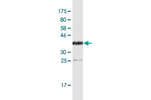 Image no. 3 for anti-Coagulation Factor III (thromboplastin, Tissue Factor) (F3) (AA 45-154) antibody (ABIN947845)