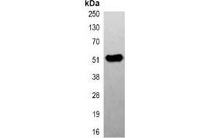 Image no. 1 for anti-Tubulin, beta 2A (TUBB2A) antibody (ABIN2852700)