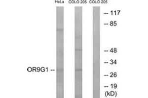 Image no. 1 for anti-Olfactory Receptor, Family 9, Subfamily G, Member 1 (OR9G1) (AA 158-207) antibody (ABIN1535969)
