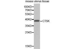Image no. 1 for anti-Cathepsin K (CTSK) antibody (ABIN3022539)