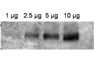 Western blot using  affinity purified anti-ABCB1 antibody shows detection of ABCB1 in crude membrane extracts from HF insect cells over-expressing human ABCB1.