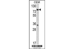 Image no. 1 for anti-Transglutaminase 4 (Prostate) (TGM4) (AA 135-164) antibody (ABIN390905)