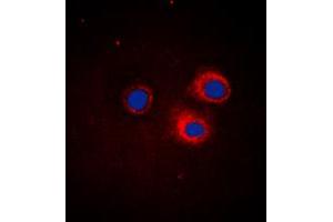 Image no. 1 for anti-Nuclear Factor of kappa Light Polypeptide Gene Enhancer in B-Cells Inhibitor, epsilon (NFKBIE) (Center) antibody (ABIN2972613)