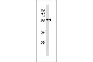 Image no. 1 for anti-Patatin-Like phospholipase Domain Containing 2 (PNPLA2) (AA 49-78), (N-Term) antibody (ABIN1881664)