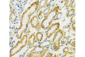 Immunohistochemistry of paraffin-embedded Rat kidney using HSPA9 Polyclonal Antibody at dilution of 1:100 (40x lens).