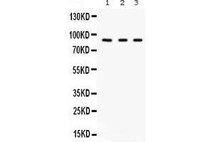 Image no. 2 for anti-Complement Factor B (CFB) (AA 518-764) antibody (ABIN4886536)