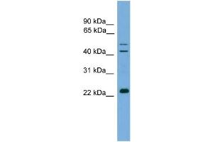 Image no. 2 for anti-Calcium Binding Protein P22 (CHP) (N-Term) antibody (ABIN2784874)