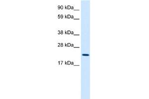 Image no. 1 for anti-Protein L-Myc (MYCL) (Middle Region) antibody (ABIN2776440)