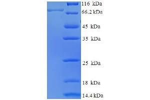 Image no. 1 for BCL2-Associated Athanogene 3 (BAG3) (AA 2-577) protein (His-SUMO Tag) (ABIN5711785)