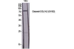 Image no. 2 for anti-Collagen, Type I, alpha 2 (COL1A2) (cleaved), (Gly1102) antibody (ABIN3181801)