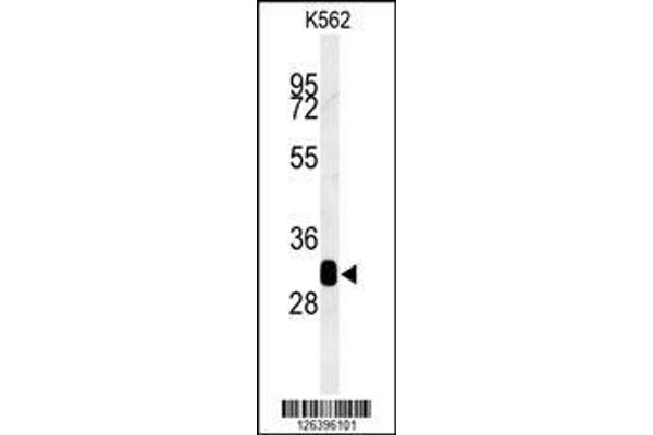 anti-Retinol Dehydrogenase 16 (All-Trans) (RDH16) (AA 3-31), (N-Term) antibody