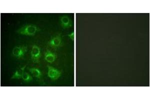 Image no. 3 for anti-V-Crk Sarcoma Virus CT10 Oncogene Homolog (Avian) (CRK) (AA 187-236) antibody (ABIN1532240)