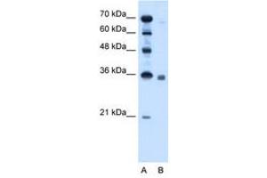anti-Sphingosine-1-Phosphate Phosphatase 2 (SGPP2) (AA 301-350) antibody