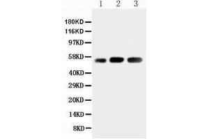 Image no. 1 for anti-KIN, Antigenic Determinant of RecA Protein Homolog (KIN) (AA 48-64), (N-Term) antibody (ABIN3042645)