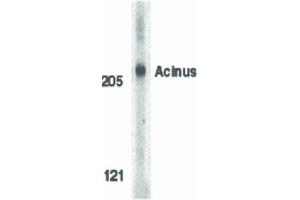 Image no. 2 for anti-Apoptotic Chromatin Condensation Inducer 1 (ACIN1) (Internal Region) antibody (ABIN6655074)