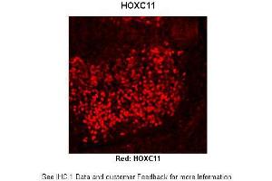Image no. 2 for anti-Homeobox C11 (HOXC11) (Middle Region) antibody (ABIN2779771)