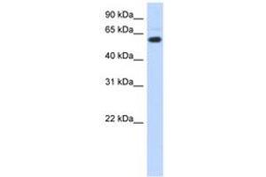 Image no. 1 for anti-Chromodomain Protein, Y-Like (CDYL) (AA 51-100) antibody (ABIN6743515)