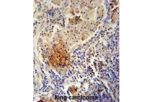 TYROBP antibody  (C-Term)