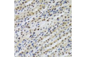 anti-Retinoblastoma Binding Protein 4 (RBBP4) antibody