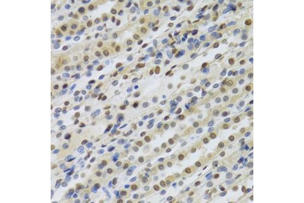 anti-Retinoblastoma Binding Protein 4 (RBBP4) antibody