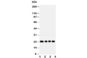 Western blot testing of FGF22 antibody and rat samples:  1.