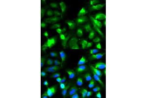 Image no. 1 for anti-Synaptosomal-Associated Protein, 25kDa (SNAP25) antibody (ABIN3021232)