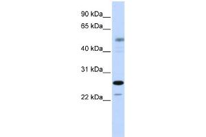 Image no. 1 for anti-PSMC3 Interacting Protein (PSMC3IP) (C-Term) antibody (ABIN2773902)