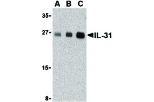 Image no. 1 for anti-Interleukin 31 (IL31) (Internal Region) antibody (ABIN6655730)