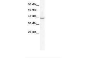 Image no. 2 for anti-T-Box 1 (TBX1) (AA 396-445) antibody (ABIN202658)