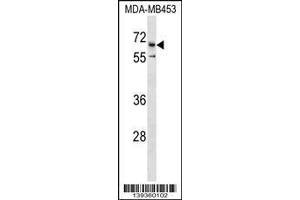 Image no. 1 for anti-Cation Channel, Sperm Associated 2 (CATSPER2) (AA 472-500), (C-Term) antibody (ABIN1537377)