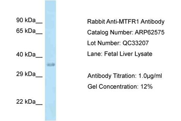 anti-Mitochondrial Fission Regulator 1 (MTFR1) (C-Term) antibody