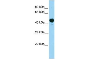 Image no. 1 for anti-Acetoacetyl-CoA Synthetase (AACS) (N-Term) antibody (ABIN2788594)