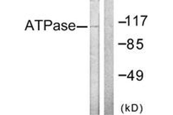 ATPase antibody  (AA 5-54)